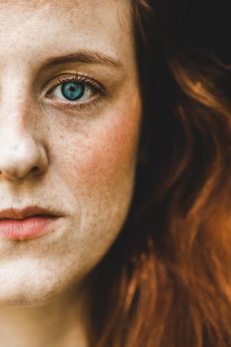 skin irritation and aging